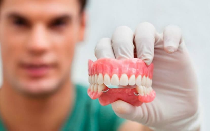 Prótesis Fija - Clínica Dental Zegarra